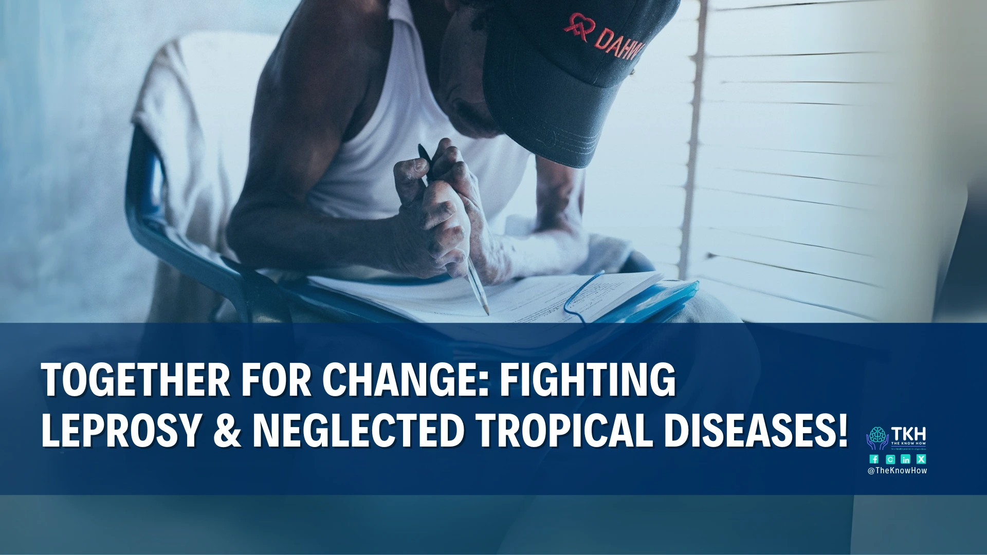 Leprosy – What Do you Know About?