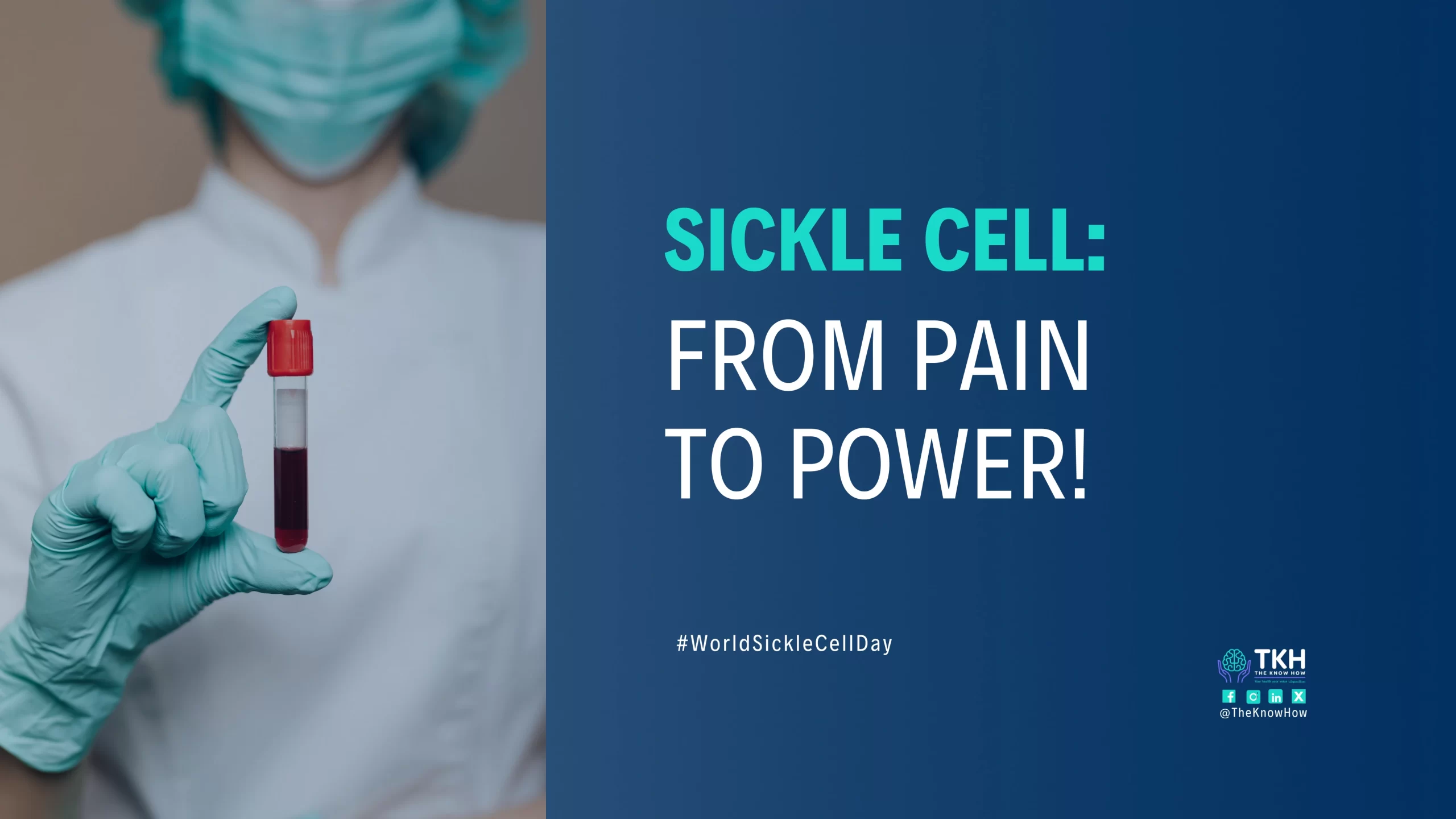 Sickle Cell Disease
