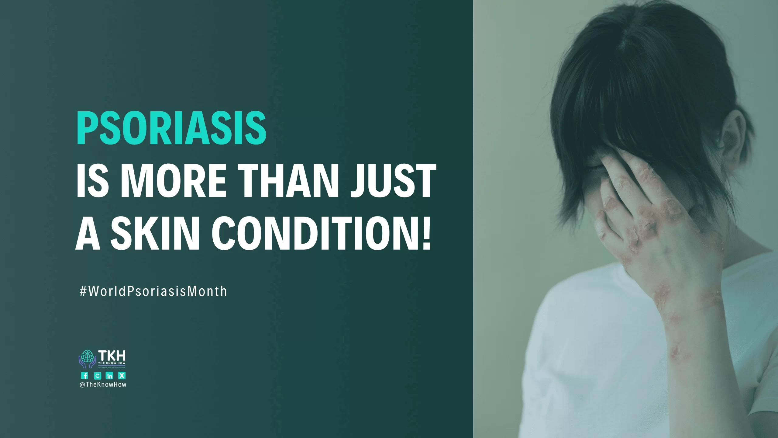 Psoriasis Awareness Month – Sensibilisation et Solutions!